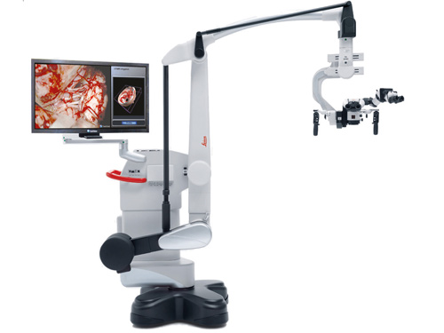 3D手术显微镜